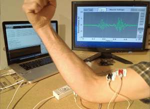 EMG 300x218