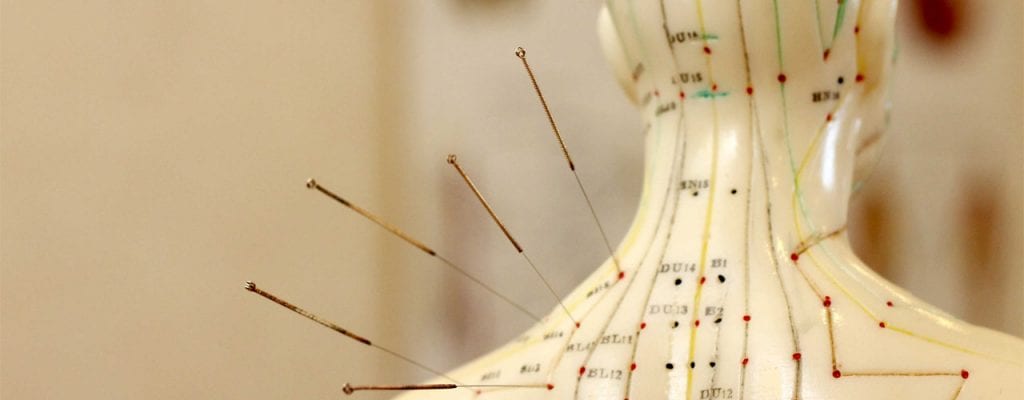 Accupuncture 2 1024x400