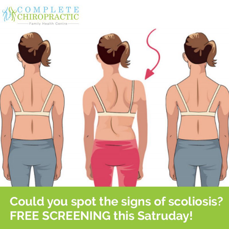 It’s scoliosis awareness month – don’t miss your FREE screening this weekend!