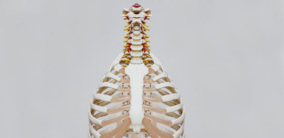 Neck Arthritis: Can we treat it?