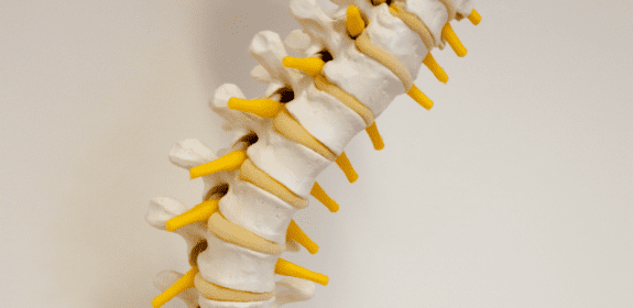 Why Scoliosis screening is important!