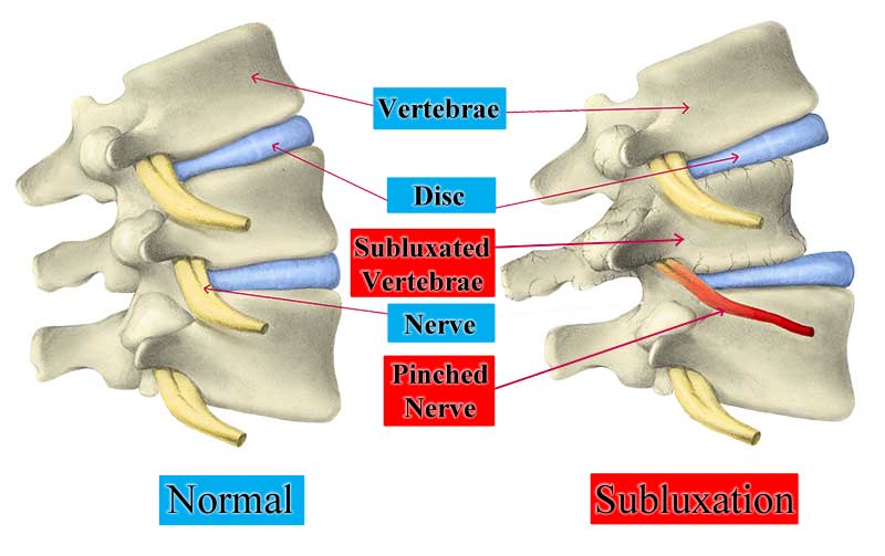 The truth about neck pain (and how to banish it!)